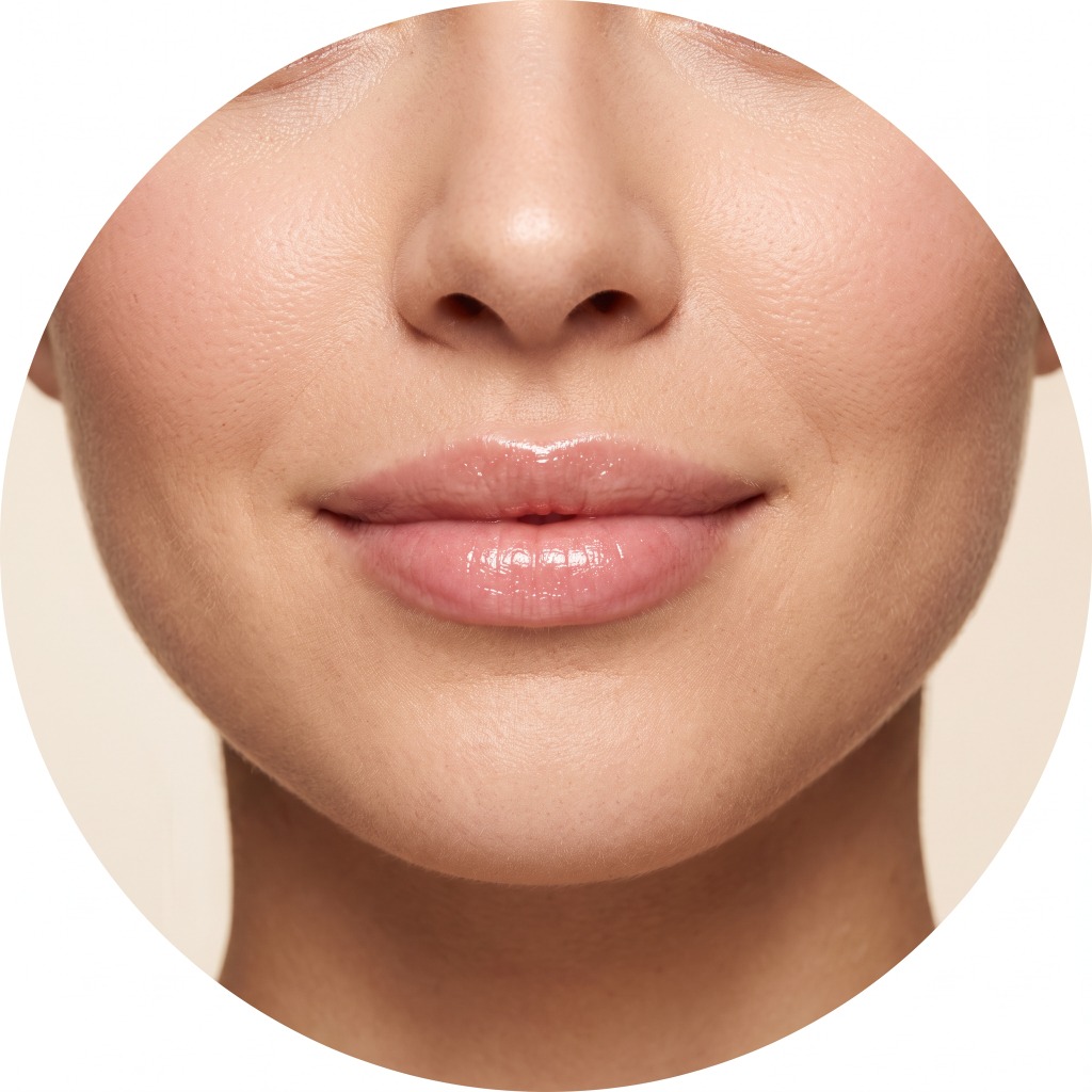 Preenchimento Labial